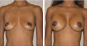 Before & After Photos